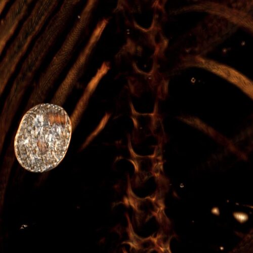 2천300년된 이집트 소년 미라에서 부적 49개 발견