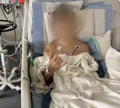 얼굴에 총 맞은 어번 15세 아버지, 총기 폭력 종식 호소